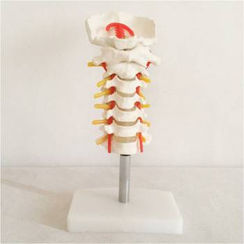颈椎带颈动脉模型脊椎典型病变胸椎自然大脊椎