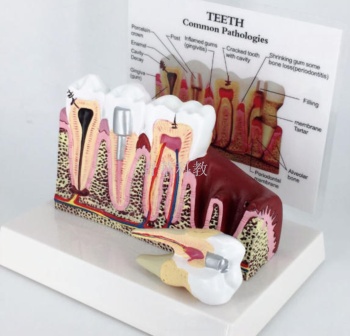 牙齿模型 口腔模型 牙科模型 教学模型 人体模型