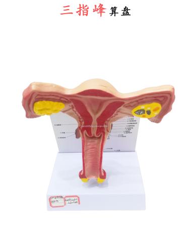 human model female reproductive uterus hospital use pathological uterus model teaching aids anatomy of ovary three-finger peak