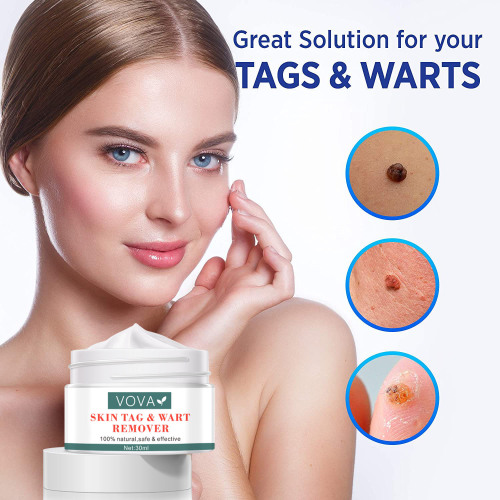 cross-border exclusive for vova skin tag & wart remover cream 30ml amazon