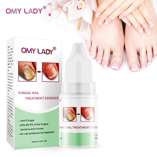 Omy Lady Nail Solution Broken Nail Care Solution 10ml Foreign Trade Exclusive