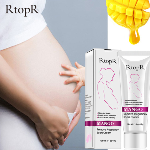 Rtopr Mango Remove Pregnancy Scars Cream Ren Zhen Cream 40G Cross-Border Supply 027