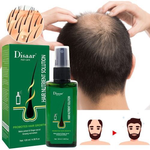 Cross-Border Amazon Scalp Nutrient Solution Hair Repair Moisturizing and Nourishing Tough Dense Hair Spray Wholesale Hair Spray